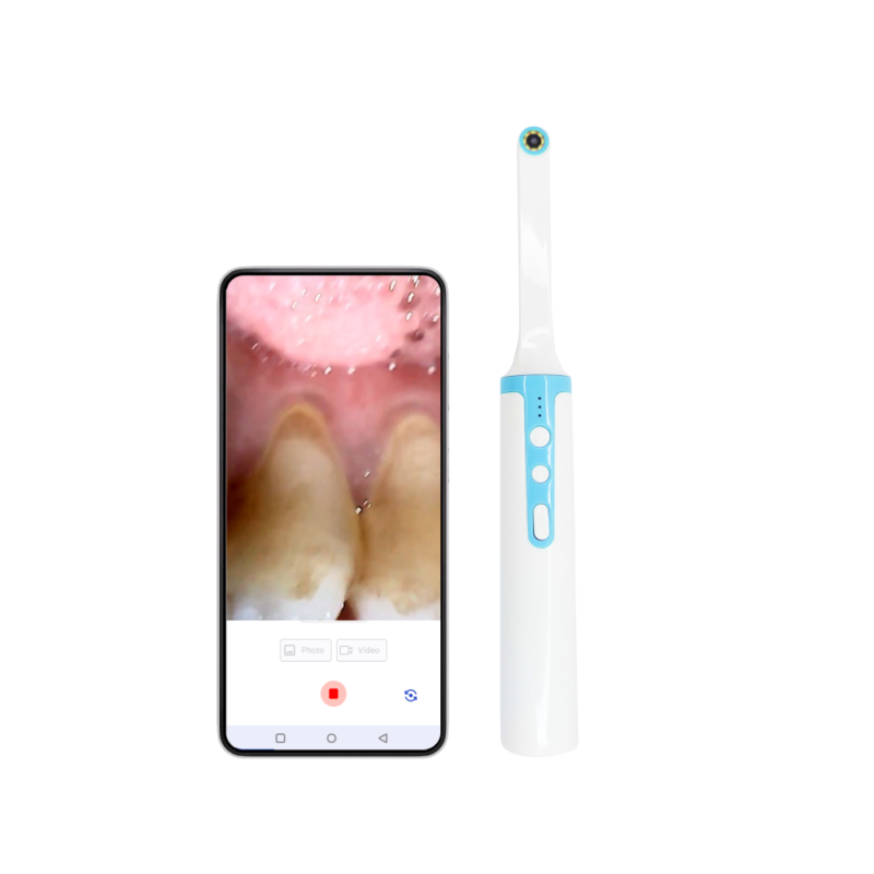 Toothlens