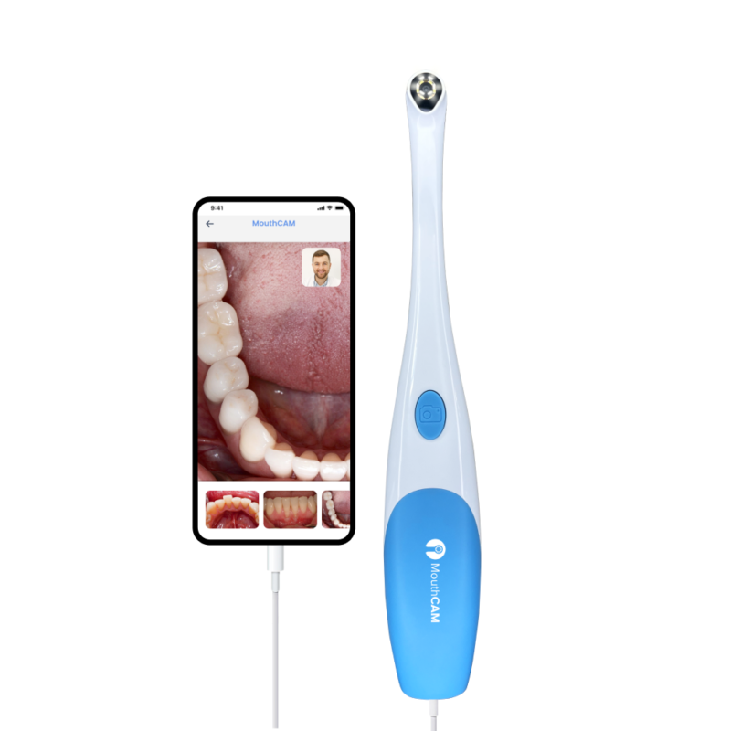 Wired Dental Camera
